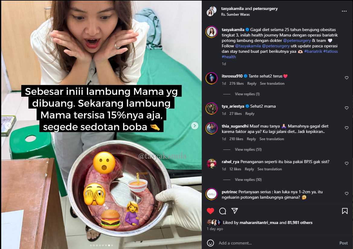 Tasya Kamila syok dengan lambung ibunya yang diangkat.